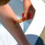 Child applying a bandage to a scraped knee near a pool