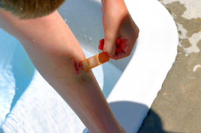 shutterstock_433818.jpg Child applying a bandage to a scraped knee near a pool